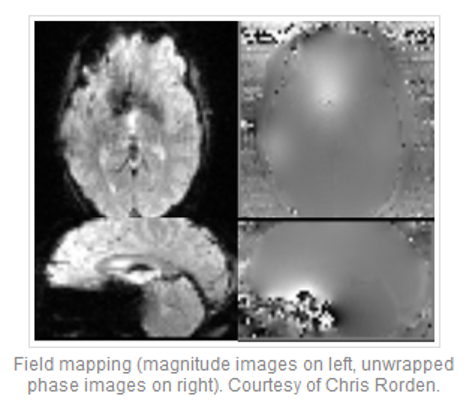 Image source: https://mriquestions.com/susceptibility-artifact.html